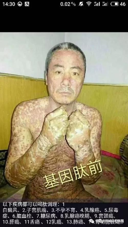 北方基因小分子肽治百病?泰博吉信曝涉传